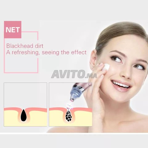 Nettoyeur électrique pores aspiration points noir - 3