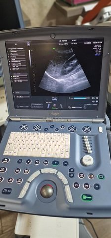Echographe GE VOLUSON i