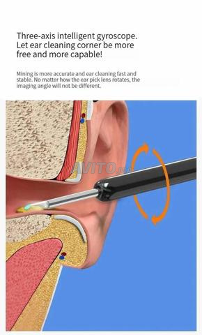 Nettoyant Visuel Intelligent Pour Les Oreilles - 2
