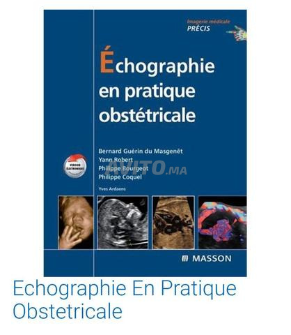 Livre echographie en pratique obstétricale