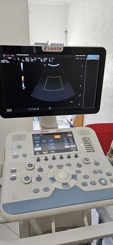 échographie 