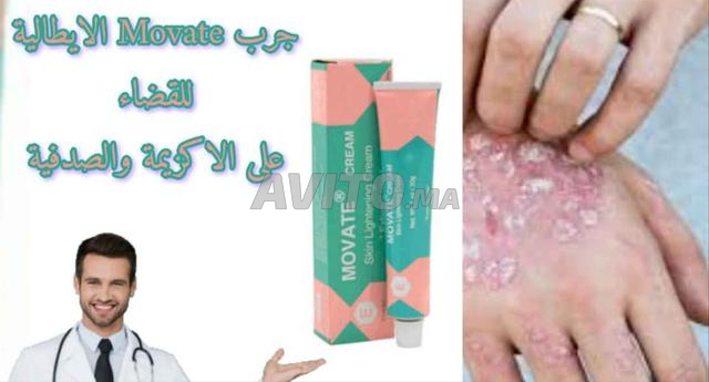 للقضاء على الاكزيما 3 ب100 درهم