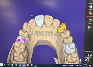 Exocad 3.2 كاملة للمختبرات وأطباء الأسنان