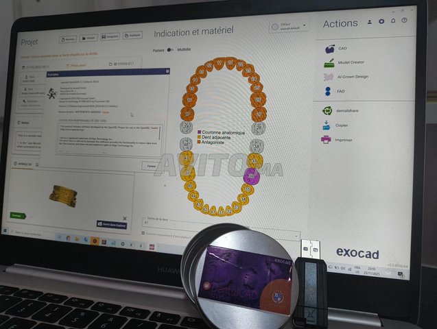 Exocad 3.2 Elefsina كاملة مع أكثر من 1000 بيبلو