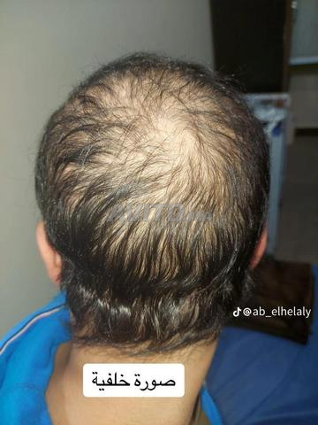 السلام عليكم ناس لي كتعاني من تونيا