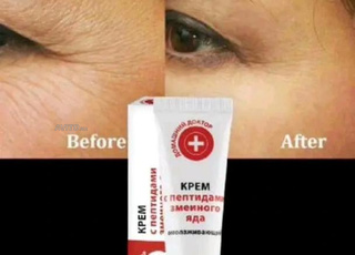 كريم لتجاعيد فعال وجرب بحال ديرا بتوكس