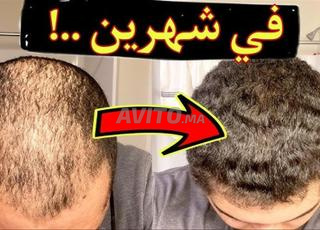 أعشاب طبيعية ديال الصحراء لزيادة شعر من الأمام