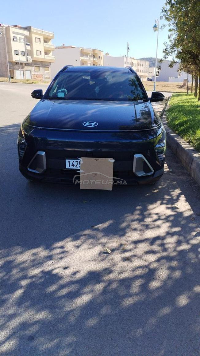 voilà je me m'a belle voiture en vente 