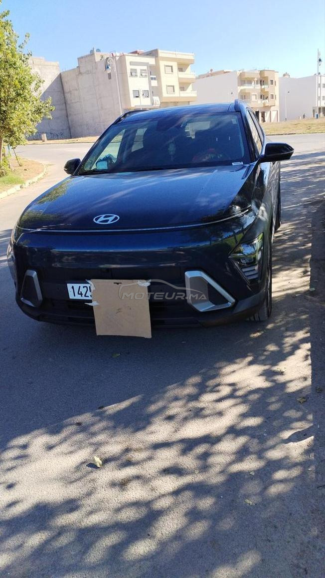 voilà je me m'a belle voiture en vente 