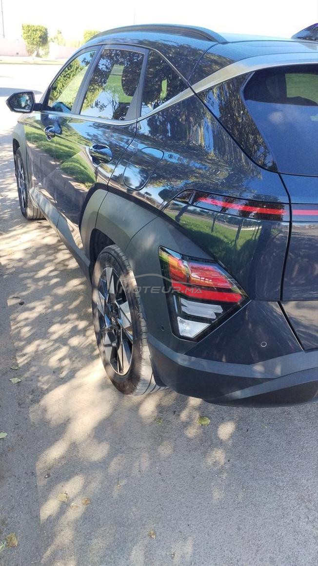 voilà je me m'a belle voiture en vente 