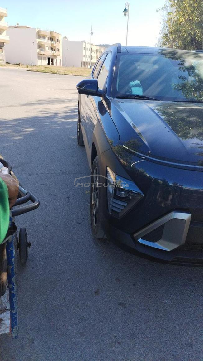 voilà je me m'a belle voiture en vente 