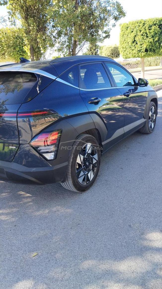 voilà je me m'a belle voiture en vente 