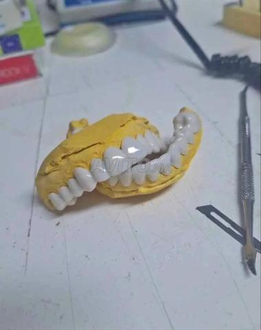 سناب اون سمايل snap on smile بالعبار - 2