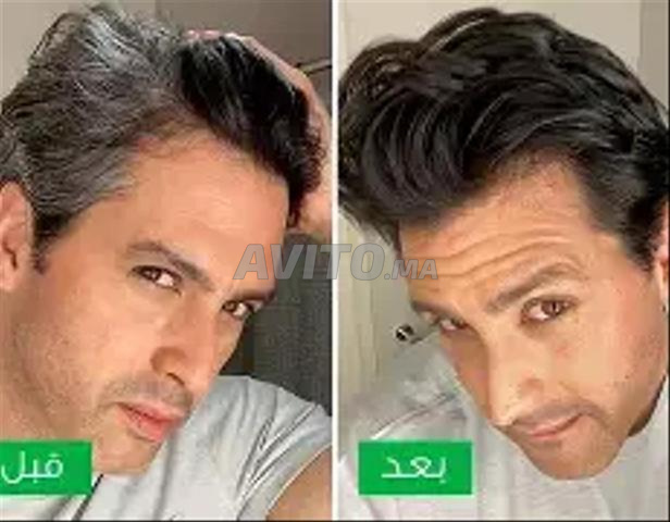 Control GX شامبو  إزالة الشعر الرمادي تدريجياً   