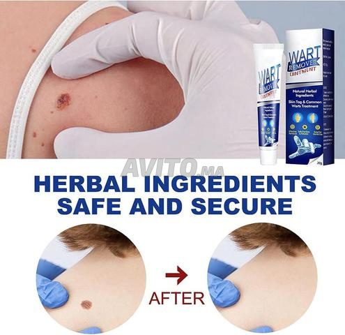 كريم لإزالة الثآليل وعلامات الجلد - 2