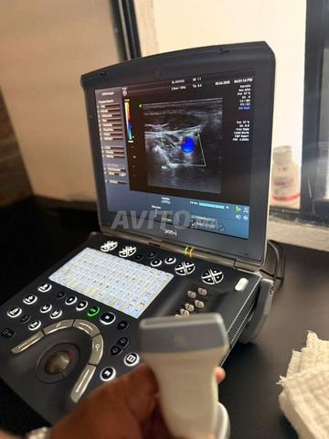 Échographe Voluson - 2