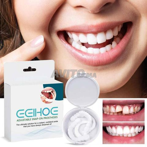 Prothèse Dentaire Ajustable أطقم السنية المؤقتة