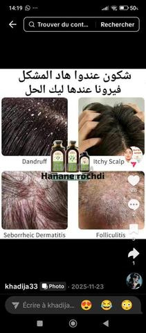 La solution ultime contre les pellicules et la chute des cheveux