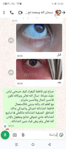 دهان مرهم البهاق والبرص - 2