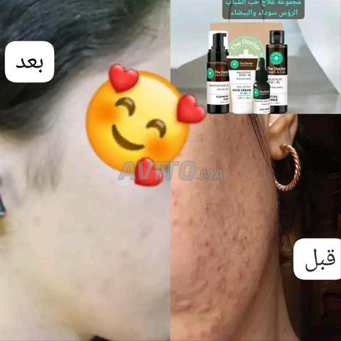 Gestionnaire des boutons et purification du visage - 2