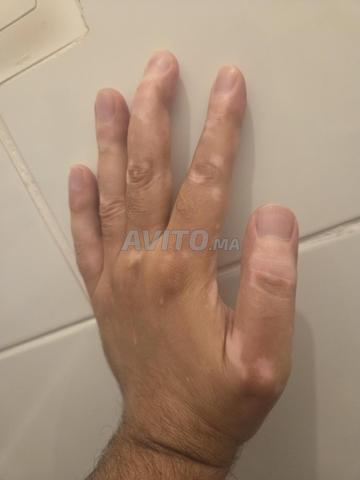 Opzelura crème - 2