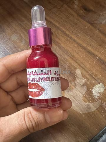 مورد الشفاه والخدود - 2
