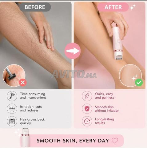 مزيل الشعر الكهربائي مزدوج الرأس - 2