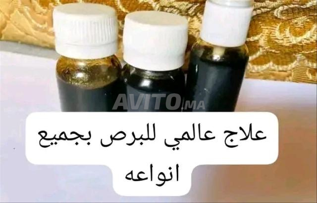 دهان ممتاز لعلاج البهاق بجميع أنواعه. - 2