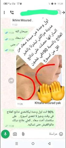 دهان البهاق - 2