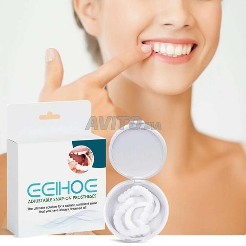 Facettes Dentaires Amovibles - Snap-On Smile - 2