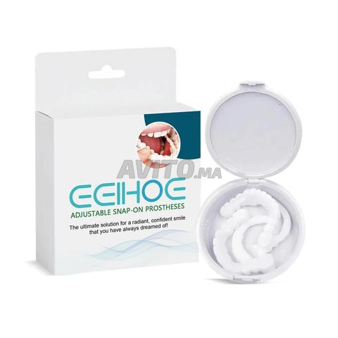 Facettes Dentaires Amovibles — Snap-On Smile