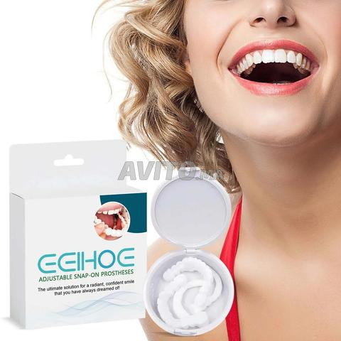 فينير الأسنان القابلة للإزالة — Snap-On Smile - 2