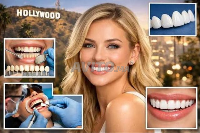 snap on smile - 2