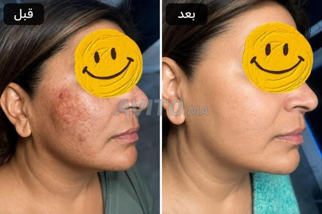 دار بيضاء، الرحمة - 2