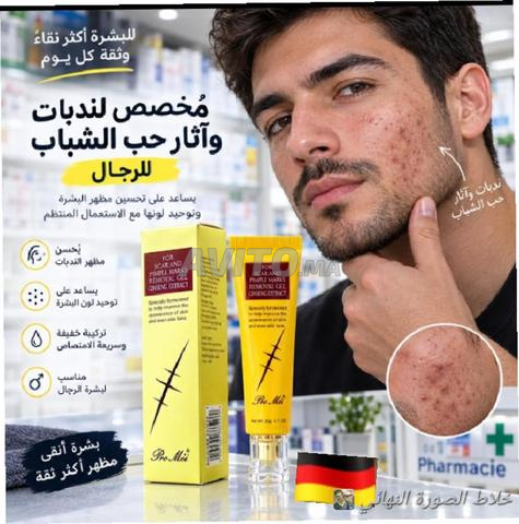كريم لإزالة ندبات الحروق وحفر حب الشباب