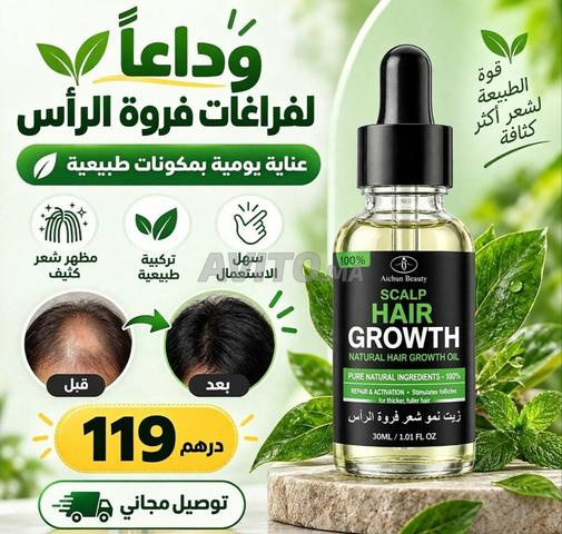 حل مشكلة تساقط الشعر ونمو الشعر - 2