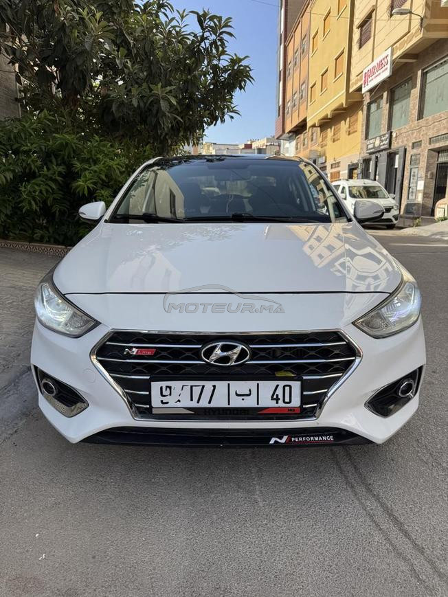 La voiture n'a aucun problème.