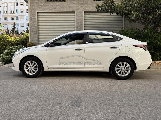 La voiture n'a aucun problème.