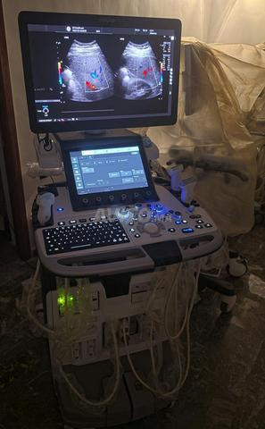 GE Logiq E10 - 2