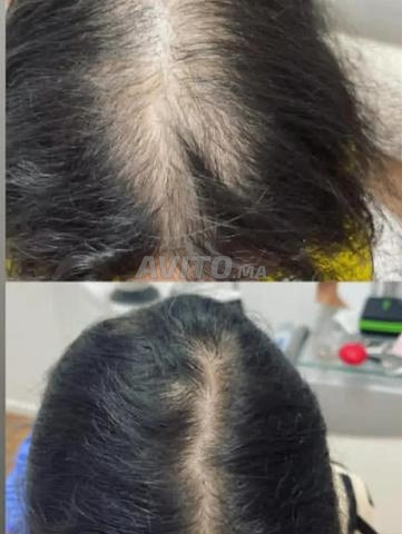 زيت راقٍ طبيعي للشعر مكون من أعشاب مخمرة - 2