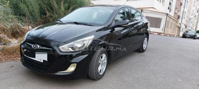 Accent 2017 tte option 
